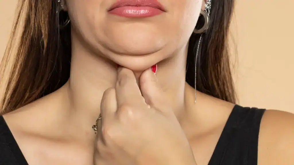 An image of a woman with double chin, sad, worried : Non Surgical Double Chin Removal Treatment in Hampshire, UK