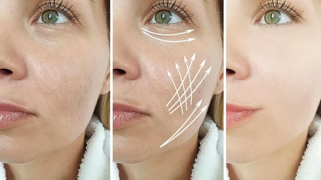 Can One Treatment Really Tackle More Than One Skin Concern Hampshire?