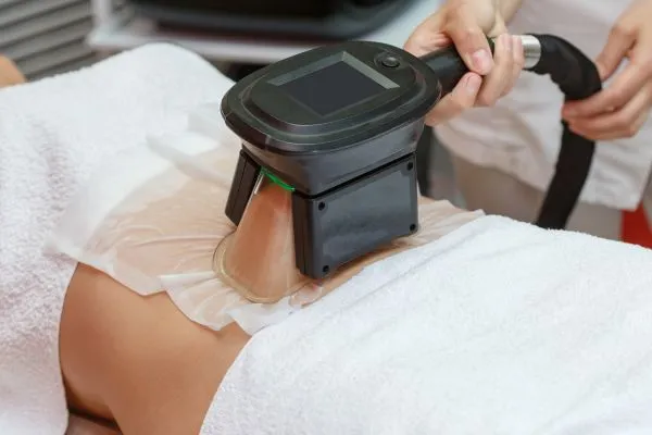 Image of person having fat freezing treatment to help weight gain Hampshire