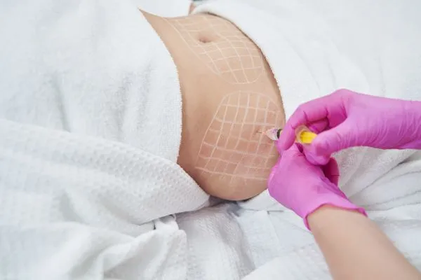 image of fat dissolving injections on love handles to help combat weight gain Hampshire
