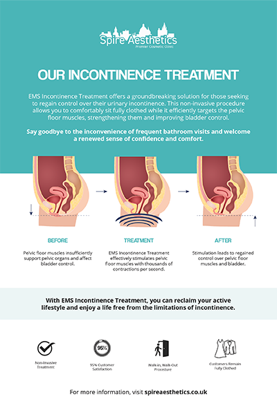 image to show how EMS treatment works for female urinary incontinence Hampshire