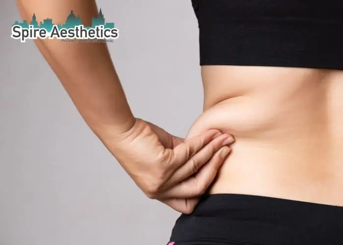 Image of woman pinching fat on their hips Hampshire. Fat Freezing treatment