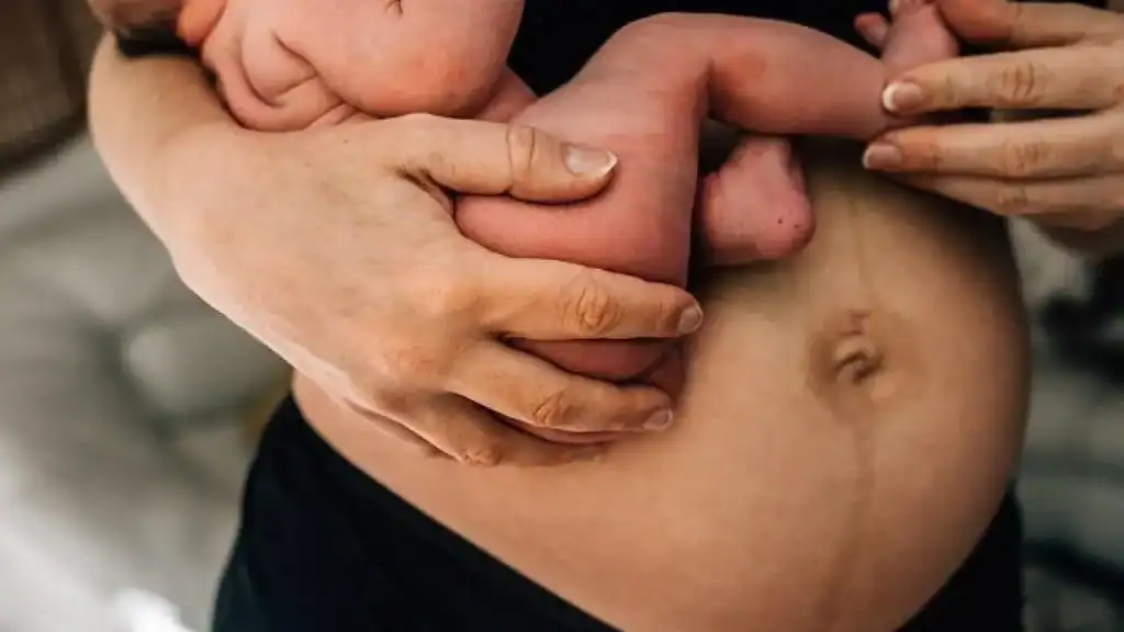 Why Is My Stomach Still Big After Pregnancy Hampshire?